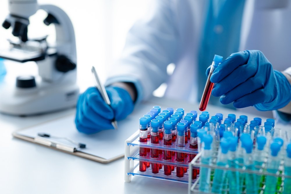 Lab Report