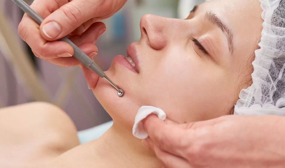 Pigmentation & Dark Spot Correction