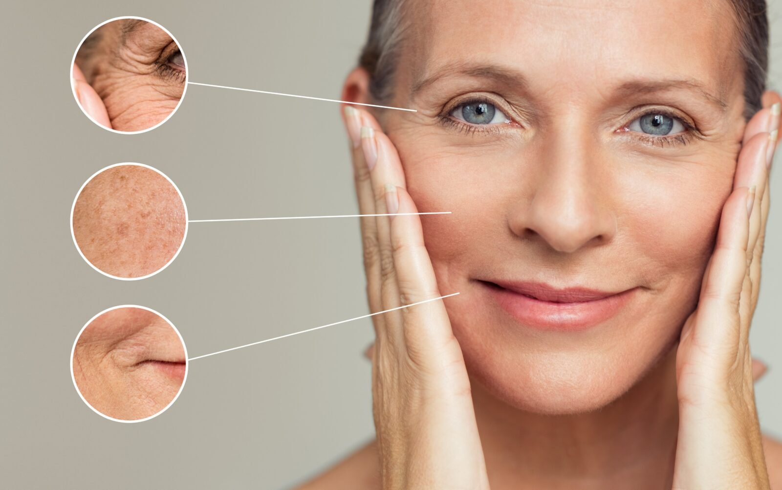 Liquid Facelifting