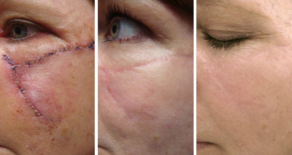 Skin Screening